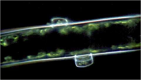 Two Cocconeis diatoms on a filament of algae.
