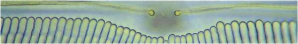 Diatom (Pinnularia) frustule, central area. x2000