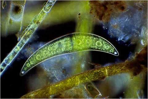 Closterium amongst filamentous algae.