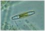 Navicula diatom amongst debris.