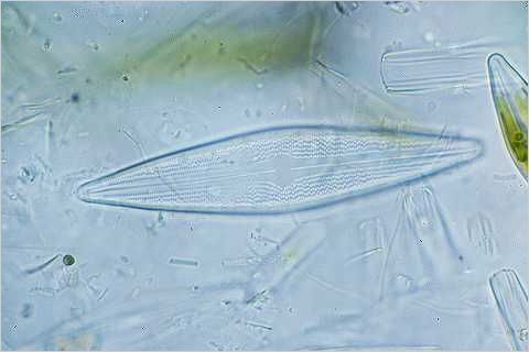 Navicula diatom amongst debris.