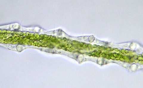 Tentacle of Hydra viridis showing nematocysts. 