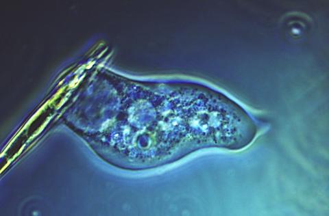 Amoeba engulfing diatom.