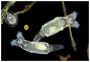 Two Philodina rotifers